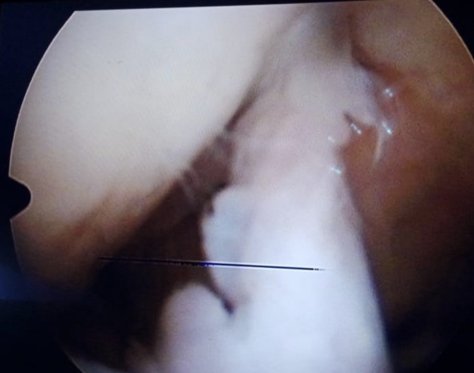 Surgery Image