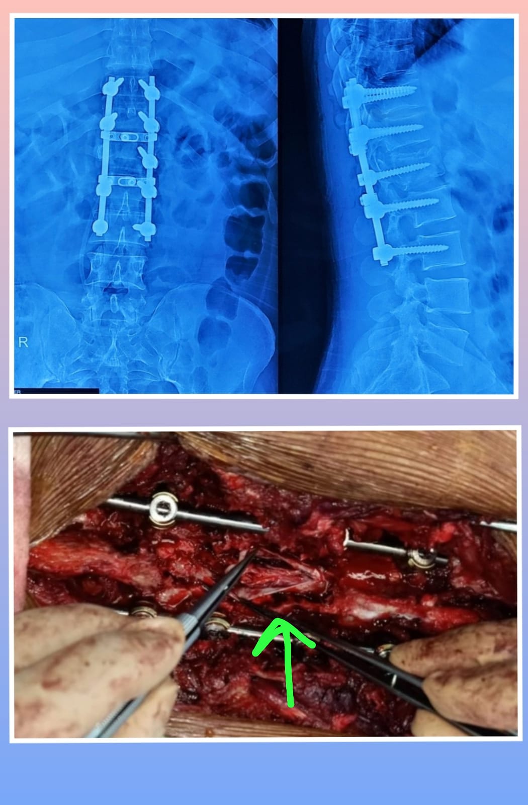 Surgery Image
